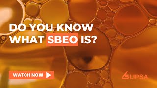 Do you know what SBEO is [upl. by Johnette536]