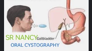 oral cholecystography procedure [upl. by Odrareg]