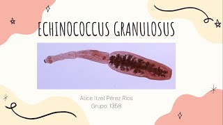 Echinococcus Granulosus Hidatidosis Unilocular [upl. by Airdnekal]