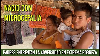 Nacio con microcefalia padres enfrentan esta adversidad en extrema pobreza y necesidad [upl. by Ivatts]