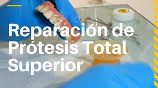 PrótesisTotales REPARACIÓN Rápida y Sencilla 👅ProtesisTotales dentaltip [upl. by Koenraad200]