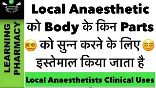 10  Local Anaesthetic को Body के किन Parts को सुन्न करने के लिए इस्तेमाल किया जाता है  notes [upl. by Neehsar]