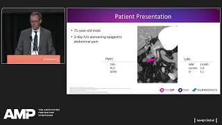 Dr Eric Scott Aspiration vs Mechanical Thrombectomy for Treatment of an SMA Occlusion [upl. by Nnaihs]