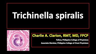 Trichinella spiralis [upl. by Niliram]