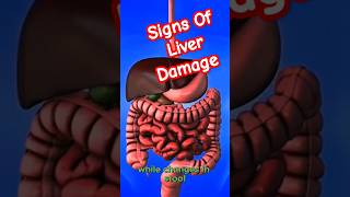 Liver Disease  Liver Disease Symptoms  Acute Liver Failure  Fatty Liver  Liver Damage [upl. by Iznyl]