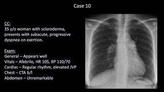 How to Interpret a Chest XRay Lesson 10  Self Assessment Part 2 [upl. by Dnamra]