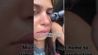 MICRONEEDLING at home OUCHHH shorts skincare beauty youtubeshorts [upl. by Yatnwahs416]