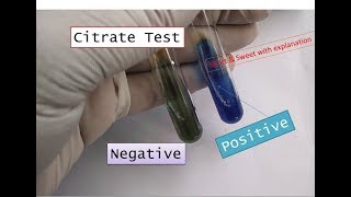 Citrate Utilization test positiveCitrate testCitrate positive bacteria in microbiology practical [upl. by Preciosa696]