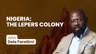 NIGERIA THE LEPERS COLONY [upl. by Mariana674]