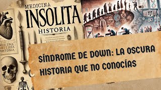 Síndrome de Down La Oscura Historia que No Conocías [upl. by Notlil]