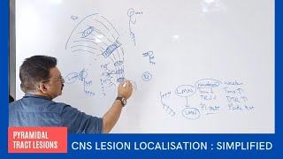 CNS Lesion Localisation at your Finger Tips by Dr Gireesh Kumar KP  Simplified Version [upl. by Googins699]