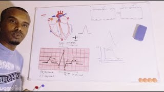 Physiology14ECG Electrocardiogram AfSoomaali [upl. by Sol]