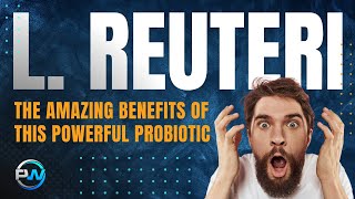 Lactobacillus Reuteri Probiotic Benefits Of Lactobacillus For Optimizing Your Health L Reuteri [upl. by Buckie706]