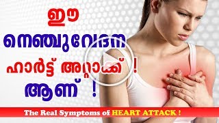 Heart Attack Symptoms And Prevention in Malayalam  Chest Pain ഹാർട്ട് അറ്റാക്ക് Ethnic Health Court [upl. by Yeneffit648]