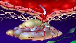 Introduction to Cancer Biology Part 4 Angiogenesis [upl. by Farlay]