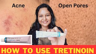 Tretinoin Cream  How to use TRETINOIN 0025 cream acneproneskin skincare acne viralproducts [upl. by Hailed]