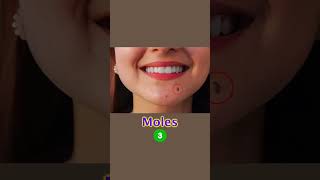 How to manage moles amp open pore Skin Care Tips  Dr Sarin [upl. by Noyart]