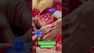 Intravenous IVcannulation । Cannulation Technique । Vgo kaise Lagaye ।। cannulation ivinjection [upl. by Falkner]