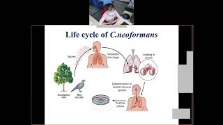 Opportunistic Mycoses by Dr A B Khyrem NEIGHRIMS Shillong [upl. by Ytineres]