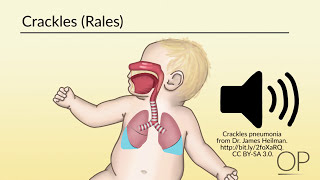 Respiratory Assessment by B Leary L DelSignore  OPENPediatrics [upl. by Tenahs]