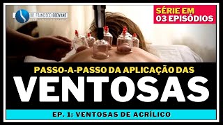 VENTOSATERAPIA  PASSOAPASSO para Aplicar as Ventosas de Acrílico AULA 13 [upl. by Meli]