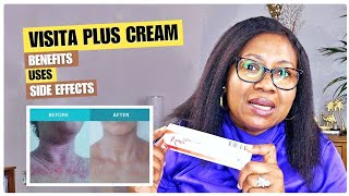 Vista Plus Cream amp Skin Bleaching How To UseBENEFITSSIDE EFECTS [upl. by Bondon460]