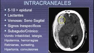 Evaluacion del paciente pediatrico politraumatizado [upl. by Ileane]