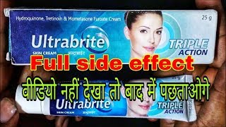 Ultrabrite Cream Side Effect Full Review PharmaMedicine [upl. by Senior151]