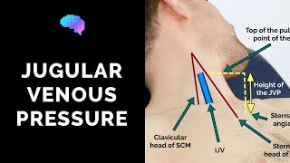 Measuring Jugular Venous Pressure JVP  OSCE Guide Clip  UKMLA  CPSA [upl. by Feld]