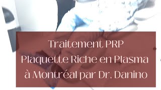 TRAITEMENT PRP CONTRE LA CALVITIE  PERTES DE CHEVEUX  PLAQUETTES RICHES EN PLASMA  DR DANINO [upl. by Kendra]