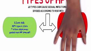 HPV genital warts [upl. by Tnelc]