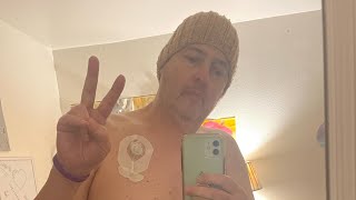 Removing my portable chemotherapy infusion pump from my Port [upl. by Dogs]