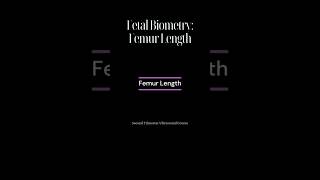 Femur Length FL [upl. by Llednohs780]