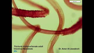 Trichuris trichiura Adult Female Intestinal Nematode [upl. by Enilatan214]