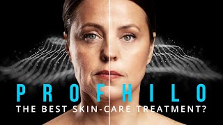 Profhilo The Best SkinCare Treatment [upl. by Robison588]