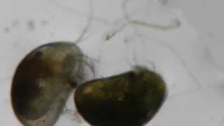 Ostracod live under the scope [upl. by Nomolos579]