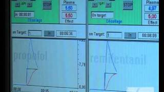 ClosedLoop Coadministration of Propofol and Remifentanil [upl. by Cardon]