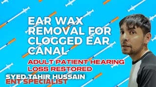 Precise Earwax Removal for Blocked Ear Canal Restoring Hearing Loss Quickly and Safely [upl. by Joachima]