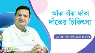 আঁকা বাঁকা ফাঁকা দাঁতের চিকিৎসা  Dental Bridges Bangla Tips  DRMD Asafujjoha Raj  Doctor Tube [upl. by Ennovyhc549]