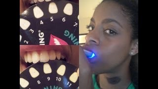 Whitening Lightening DialASmile Kit Review [upl. by Asenab]