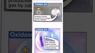 Catalase and oxidase test [upl. by Aiderfla]