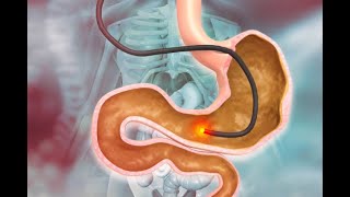 A Journey Inside How Endoscopy Works [upl. by Oibesue76]