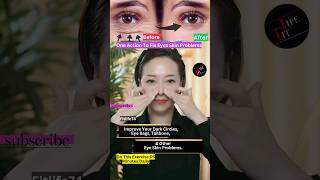 One Action To Fix Eyes Skin Problems eyelift eyeexercise yoga faceyoga facialyoga shorts [upl. by Inalaehon]