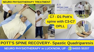 Potts Spine Physiotherapy Rehab  Best Exercises for Potts Spine  TB of Spine  Extra Care Lko [upl. by Sill]