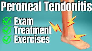 Peroneal Tendonitis Treatment  San Diego Sports Chiropractic [upl. by Dnama579]