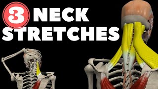 Neck Stretches for Instant pain relief [upl. by Aveline337]