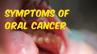 Symptoms of Oral Cancer EarlySigns [upl. by Ewer]