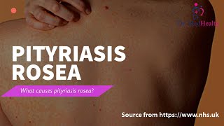 All about pityriasis rosea  causes symptoms pityriasis  pityriasis rosea treatment [upl. by Shermy]