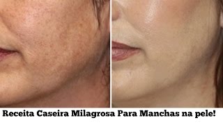 RECEITA CASEIRA PARA ACABAR COM MANCHAS NO ROSTO Rejuvenescimento Celular Caseiro [upl. by Sredna]