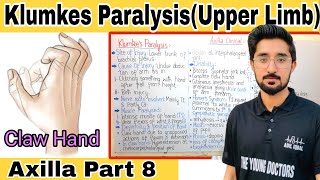 Klumkes Paralysis Brachial Plexus Clinical Klumpke Paralysis Brachial Plexus Clinical Anatomy [upl. by Phi]